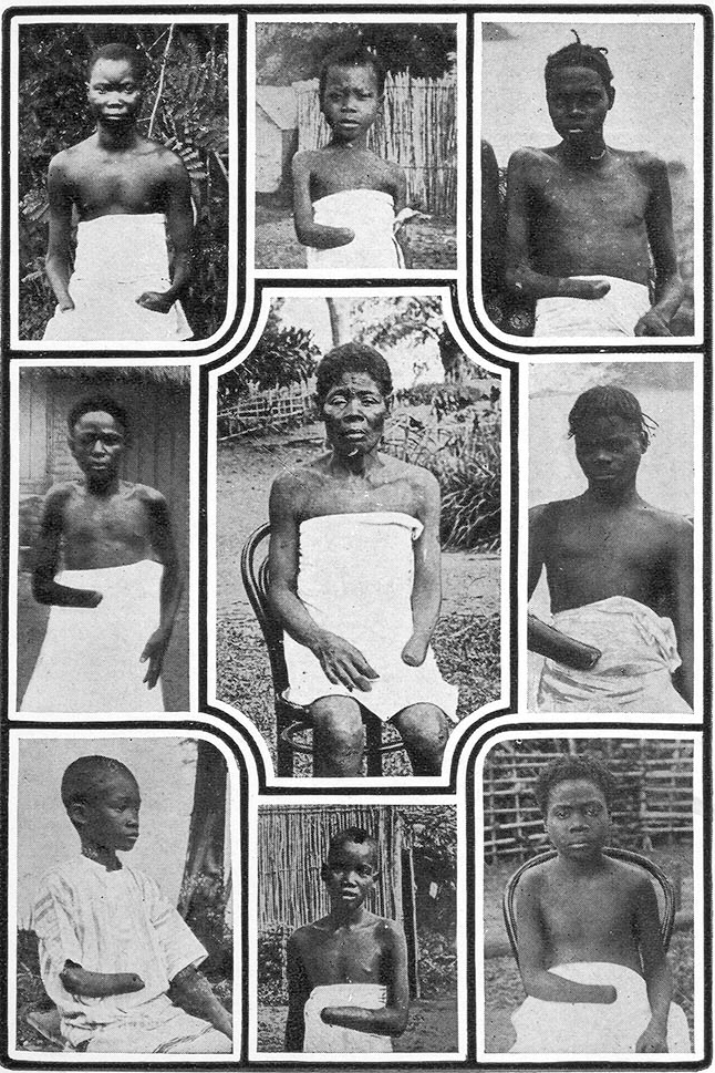 Dzieci z Kongo Belgijskiego okaleczone przez siły kolonialne (domena publiczna).