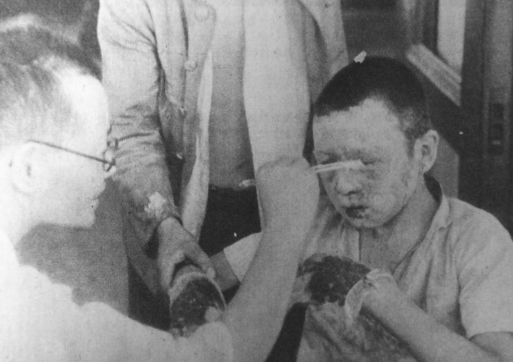 Ranny chłopiec opatrywany 10 sierpnia 1945 roku w szpitalu Czerwonego Krzyża w Hiroszimie (Hajime Miyatake/domena publiczna).