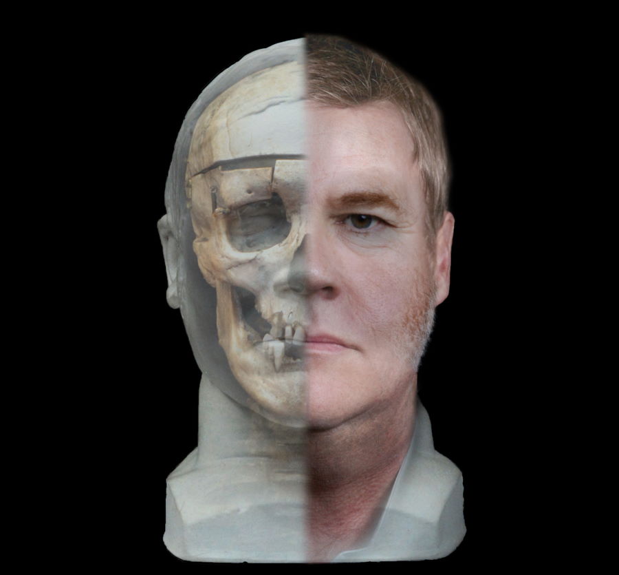Rekonstrukcja twarzy Williama Burke'a na podstawie zachowanej czaszki