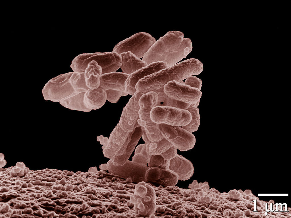 Escherichia coli w powieszeniu 10 000 razy (domena publiczna).